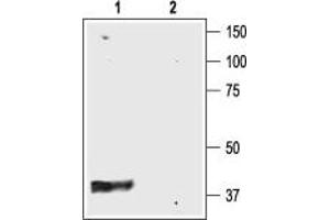 Western blot analysis of rat brain membranes: - 1.