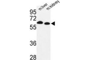 Western Blotting (WB) image for anti-Proline Dehydrogenase (Oxidase) 1 (PRODH) antibody (ABIN3003837) (PRODH antibody)