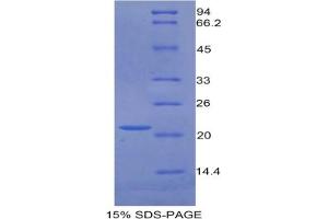 SDS-PAGE of Protein Standard from the Kit  (Highly purified E. (GAS6 ELISA Kit)