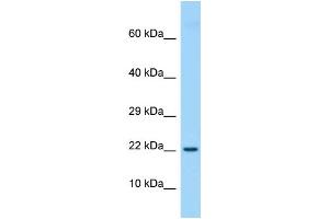 Host: Rabbit Target Name: Etv3l Sample Type: Rat Thymus lysates Antibody Dilution: 1. (ETV3L antibody  (Middle Region))