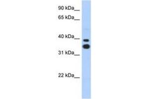 Image no. 1 for anti-Msh Momeobox 2 (Msx2) (N-Term) antibody (ABIN6742203) (Msx2/Hox8 antibody  (N-Term))