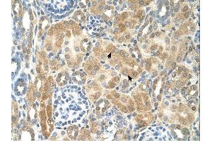 NR2F2 antibody was used for immunohistochemistry at a concentration of 4-8 ug/ml. (NR2F2 antibody  (N-Term))