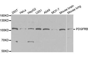 Western blot analysis of extracts of various cell lines, using PDGFRB antibody. (PDGFRB antibody  (AA 887-1106))
