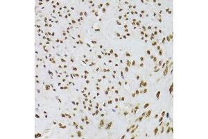 Immunohistochemistry (Paraffin-embedded Sections) (IHC (p)) image for anti-X-Ray Repair Complementing Defective Repair in Chinese Hamster Cells 6 (XRCC6) (AA 500-600) antibody (ABIN1513143)