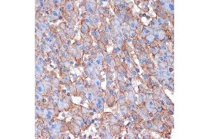 Immunohistochemistry of paraffin-embedded human liver using Alpha Fodrin Rabbit mAb (ABIN7270518) at dilution of 1:100 (40x lens). (SPTAN1 antibody)