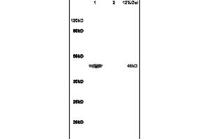 L1 rat brain lysates L2 rat heart lysates probed with Anti ADRB2 Polyclonal Antibody, Unconjugated (ABIN730153) at 1:200 in 4 °C. (beta 2 Adrenergic Receptor antibody  (AA 201-300))