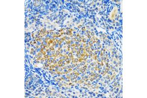 Immunohistochemistry of paraffin-embedded rat ovary using SIRT2 antibody (ABIN5970103) at dilution of 1/100 (40x lens). (SIRT2 antibody)