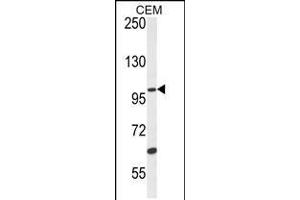 Western blot analysis in CEM cell line lysates (35ug/lane). (USP29 antibody  (AA 660-690))