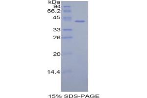SDS-PAGE analysis of Human HIST1H2AH Protein. (HIST1H2AH Protein)