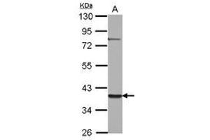 Image no. 1 for anti-Zinc Finger Protein 302 (ZNF302) (AA 1-178) antibody (ABIN1501835) (ZNF302 antibody  (AA 1-178))