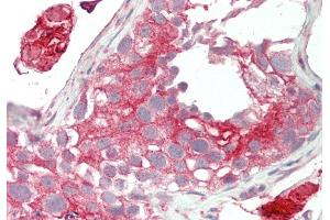 Rabbit Anti-Lrp2bp antibody  Formalin Fixed Paraffin Embedded Tissue: Human Testis Primary antibody Concentration: 1:100 Secondary Antibody: Donkey anti-Rabbit-Cy3 Secondary Antibody Concentration: 1:200 Magnification: 20x Exposure Time: 0. (LRP2BP antibody  (Middle Region))