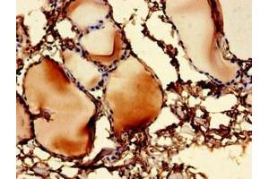 Immunohistochemistry of paraffin-embedded human thyroid tissue using ABIN7174489 at dilution of 1:100 (UBE2V1 antibody  (AA 2-147))