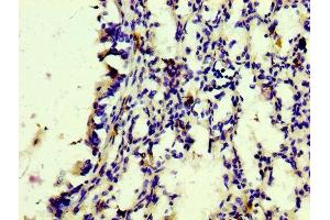IHC image of ABIN7127275 diluted at 1:100 and staining in paraffin-embedded human lung tissue performed on a Leica BondTM system. (Recombinant CD163 antibody)