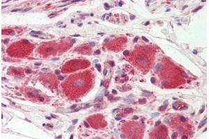 Human Ganglion Cells (Prostate): Formalin-Fixed, Paraffin-Embedded (FFPE) (KIR5.1 antibody  (AA 369-418))