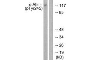 Western blot analysis of extracts from K562 cells treated with Insulin 0. (ABL1 antibody  (pTyr245))