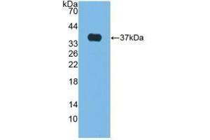 Detection of Recombinant ALP, Bovine using Polyclonal Antibody to Alkaline Phosphatase (ALP) (Alkaline Phosphatase antibody)