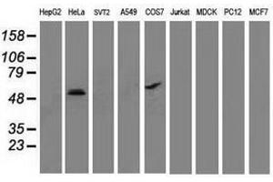Image no. 2 for anti-Tumor Protein P53 (TP53) antibody (ABIN1499971) (p53 antibody)