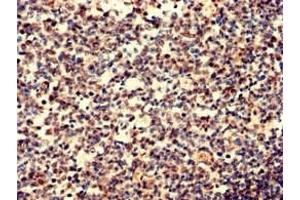 Immunohistochemistry analysis of human tonsil tissue using ABIN7156038 at dilution of 1:100 (IgD antibody  (AA 1-240))
