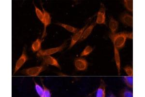 Immunofluorescence analysis of NIH-3T3 cells using VMP1 Polyclonal Antibody at dilution of 1:100 (40x lens).