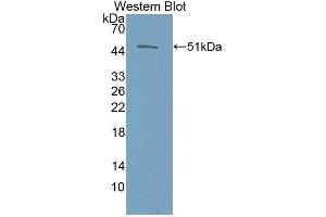 Western Blotting (WB) image for anti-Erythropoietin (EPO) antibody (Biotin) (ABIN1172018) (EPO antibody  (Biotin))
