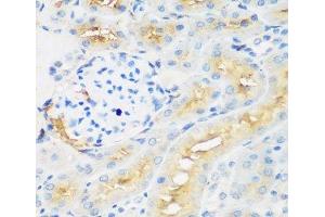 Immunohistochemistry of paraffin-embedded Rat kidney using PROCR Polyclonal Antibody at dilution of 1:200 (40x lens).