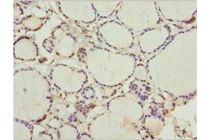 Immunohistochemistry of paraffin-embedded human thyroid tissue using ABIN7175755 at dilution of 1:100