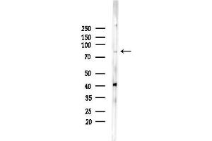 Western blot analysis of lysates from PC12 cells(UV,30 min treatment), using Methylmalonyl Coenzyme A mutase Antibody at 1/1000 dilution.