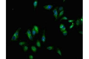 Immunofluorescent analysis of Hela cells using ABIN7151864 at dilution of 1:100 and Alexa Fluor 488-congugated AffiniPure Goat Anti-Rabbit IgG(H+L) (EPH Receptor B3 antibody  (AA 261-390))