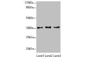 Western blot All lanes: NUP35 antibody at 12 μg/mL Lane 1: Jurkat whole cell lysate Lane 2: A431 whole cell lysate Lane 3: HepG2 whole cell lysate Secondary Goat polyclonal to rabbit IgG at 1/10000 dilution Predicted band size: 35, 34, 22 kDa Observed band size: 35 kDa (NUP35 antibody  (AA 6-305))