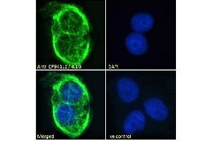 ABIN238594 Immunofluorescence analysis of paraformaldehyde fixed A431 cells, permeabilized with 0. (EPB41L2 antibody  (Internal Region))