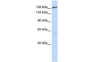ABCC1 antibody used at 1 ug/ml to detect target protein. (ABCC1 antibody)