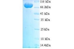 SDS-PAGE (SDS) image for Mannan-Binding Lectin Serine Peptidase 1 (MASP1) (AA 20-699) protein (His tag) (ABIN5713632) (MASP1 Protein (AA 20-699) (His tag))