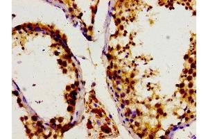 Immunohistochemistry of paraffin-embedded human testis tissue using ABIN7149710 at dilution of 1:100 (DHPS antibody  (AA 1-94))
