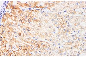 Immunohistochemistry of paraffin-embedded Human liver using IFNAR1 Polyclonl Antibody at dilution of 1:200. (IFNAR1 antibody)