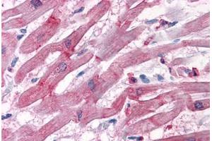 Human Heart: Formalin-Fixed, Paraffin-Embedded (FFPE) (BAG3 antibody  (AA 563-575))