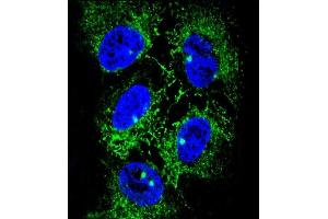 Confocal immunofluorescent analysis of ADH7 Antibody (C-Term) (ABIN653658 and ABIN2842998) with NCI- cell followed by Alexa Fluor® 488-conjugated goat anti-rabbit lgG (green). (ADH7 antibody  (C-Term))