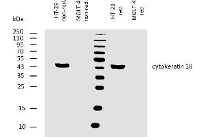 Western blotting analysis of human cytokeratin 18 using mouse monoclonal antibody DA-7 on lysates of HT-29 cell line and MOLT-4 cell line (cytokeratin non-expressing cell line, negative control) under non-reducing and reducing conditions. (Cytokeratin 18 antibody)