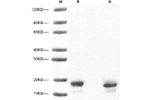 IL-10 Protein (AA 19-178)