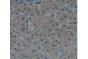 Figure. (FAS antibody  (AA 22-172))