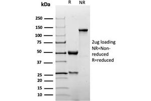 SDS-PAGE Analysis Purified p27 Recombinant Rabbit Monoclonal Antibody (KIP1/1355R). (Recombinant CDKN1B antibody)