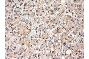 Image no. 4 for anti-Myc Proto-Oncogene protein (MYC) antibody (ABIN1497011) (c-MYC antibody)