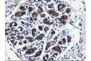 Image no. 4 for anti-RAB37, Member RAS Oncogene Family (RAB37) antibody (ABIN1500561)