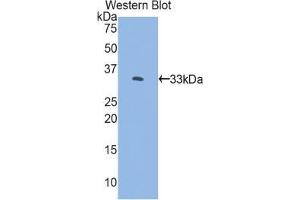 Western blot analysis of the recombinant protein. (FKBP10 antibody  (AA 158-440))