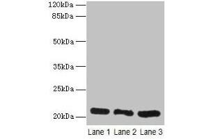 Western blot All lanes: GM2A antibody at 10 μg/mL Lane 1: Rat liver tissue Lane 2: Mouse stomach tissue Lane 3: Mouse small intestine tissue Secondary Goat polyclonal to rabbit IgG at 1/10000 dilution Predicted band size: 21 kDa Observed band size: 21 kDa (GM2A antibody  (AA 32-193))