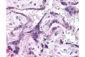 Image no. 1 for anti-Epidermal Growth Factor Receptor (EGFR) (AA 1189-1199), (pTyr1197) antibody (ABIN401341) (EGFR antibody  (pTyr1197))