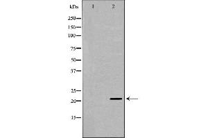 Western blot analysis of C6  using RAP1A antibody. (RAP1A antibody  (C-Term))