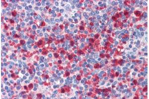 Human Spleen: Formalin-Fixed, Paraffin-Embedded (FFPE) (Polybromo 1 antibody  (AA 1511-1560))