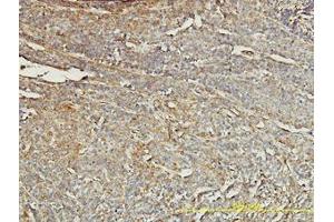 Image no. 4 for anti-Tropomyosin 4 (TPM4) (AA 1-249) antibody (ABIN598984) (Tropomyosin 4 antibody  (AA 1-249))