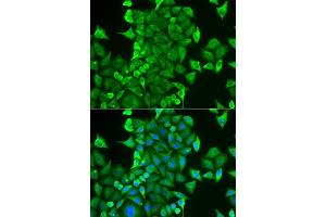 Immunofluorescence analysis of HeLa cells using CARS antibody (ABIN6129260, ABIN6137946, ABIN6137948 and ABIN6222203). (CARS antibody  (AA 469-748))