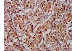 Immunohistochemistry (IHC) image for anti-Receptor-Interacting Serine-threonine Kinase 2 (RIPK2) (AA 1-540) antibody (ABIN7167474)